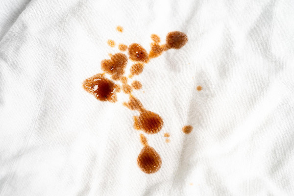 کهن تاج کیمیا - انواع لکه - مقالات